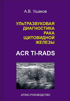 Применение TI-RADS в диагностике рака щитовидной железы. Клиника Щитовидной  Железы доктора А. В. Ушакова — официальный сайт.